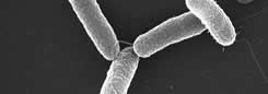 Utilizan la bacteria de la salmonella para destruir células cancerosas
